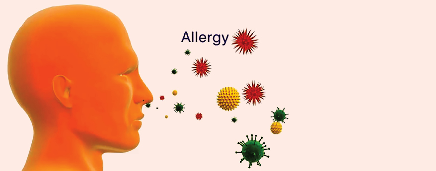 Precision Medicine in Allergy-Asthma