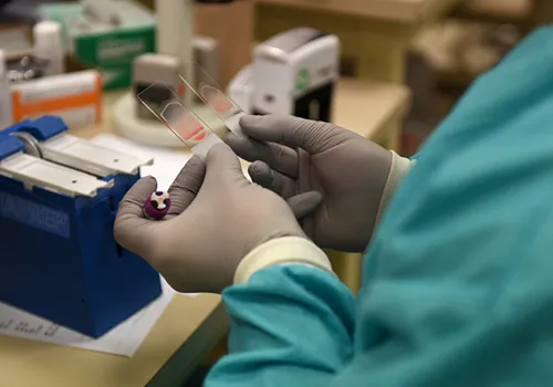 Haematology services