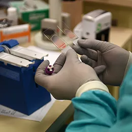 Haematology services