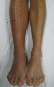 Paediatric Rheumatology