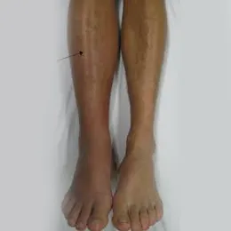 Paediatric Rheumatology