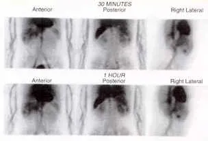 Cardiac Scan