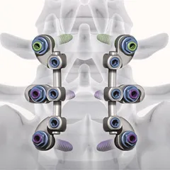 Surgical Fixation