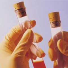 The amount of amikacin present is 400mg to 600mg, cefepime in an amount of 2g to 4g and arginine in the amount of 600mg to 1.2 gm.